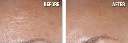 Sun + C Skin Serum